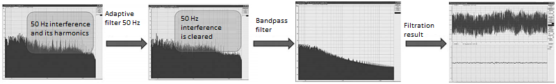 Signal before and after digital filtering